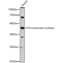 Thromboxane-A Synthase (TBXAS1) Antibody
