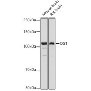 Western blot analysis of various lysates using OGT Antibody at 1/3000 dilution. Secondary antibody: HRP-conjugated Goat anti-Rabbit IgG (H+L) at 1/10000 dilution. Lysates/proteins: 25 µg per lane. Blocking buffer: 3% nonfat dry milk in TBST. Exposure time: 10s.
