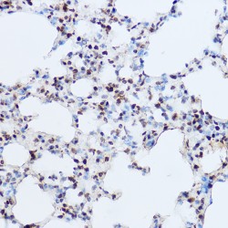 UDP-N-Acetylglucosamine--Peptide N-Acetylglucosaminyltransferase 110 kDa Subunit (OGT) Antibody