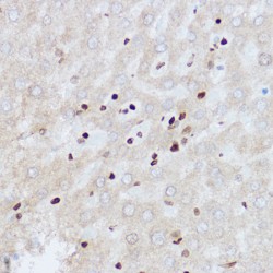 UDP-N-Acetylglucosamine--Peptide N-Acetylglucosaminyltransferase 110 kDa Subunit (OGT) Antibody