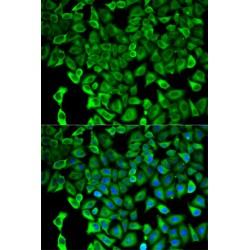 Proteasome 26S Subunit, Non ATPase 2 (PSMD2) Antibody