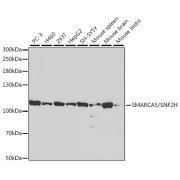Western blot analysis of various lysates using SMARCA5/SNF2H Antibody at 1/1000 dilution. Secondary antibody: HRP-conjugated Goat anti-Rabbit IgG (H+L) at 1/10000 dilution. Lysates/proteins: 25 µg per lane. Blocking buffer: 3% nonfat dry milk in TBST. Exposure time: 2min.