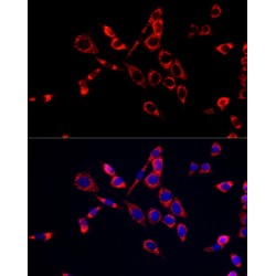 Cytidine Deaminase (CDA) Antibody
