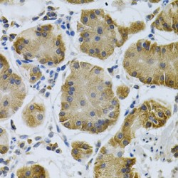 Insulin Like Growth Factor Binding Protein 4 (IGFBP4) Antibody