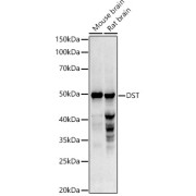 Western blot analysis of various lysates using DST Antibody at 1/1000 dilution. Secondary antibody: HRP-conjugated Goat anti-Rabbit IgG (H+L) at 1/10000 dilution. Lysates/proteins: 25 µg per lane. Blocking buffer: 3% nonfat dry milk in TBST. Exposure time: 90s.