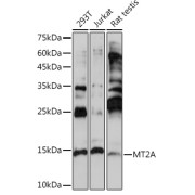Western blot analysis of various lysates using MT2A Antibody at 1/1000 dilution. Secondary antibody: HRP-conjugated Goat anti-Rabbit IgG (H+L) at 1/10000 dilution. Lysates/proteins: 25 µg per lane. Blocking buffer: 3% nonfat dry milk in TBST. Exposure time: 30s.