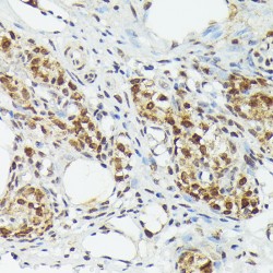 Metallothionein 2A (MT2A) Antibody