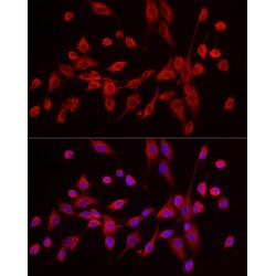 Exostosin 1 (EXT1) Antibody