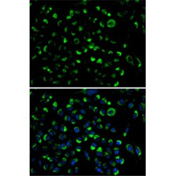 Adenylate Kinase 4, Mitochondrial (AK4) Antibody