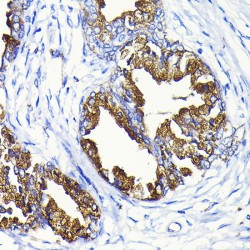 Kallikrein 1-Related Peptidase B3 (KLK1B3) Antibody