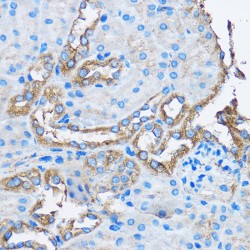 F-Actin-Capping Protein Subunit Alpha-2 (CAPZA2) Antibody