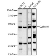 Western blot analysis of various lysates using Cyclin B1 Antibody at 1/500 dilution. Secondary antibody: HRP-conjugated Goat anti-Rabbit IgG (H+L) at 1/10000 dilution. Lysates/proteins: 25 µg per lane. Blocking buffer: 3% nonfat dry milk in TBST. Exposure time: 180s.