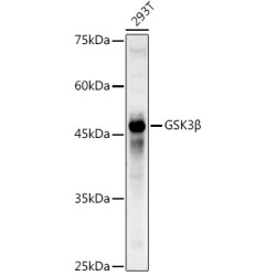 Glycogen Synthase Kinase 3 Beta (GSK3B) Antibody