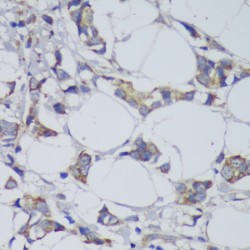 Glycogen Synthase Kinase 3 Beta (GSK3B) Antibody