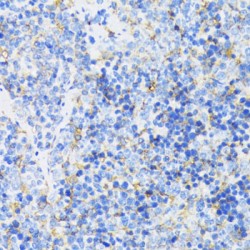 Glycogen Synthase Kinase 3 Beta (GSK3B) Antibody