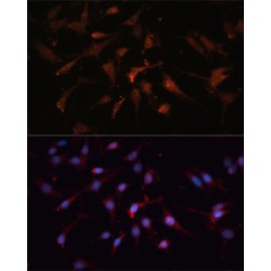 Glycogen Synthase Kinase 3 Beta (GSK3B) Antibody