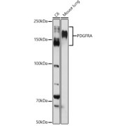Western blot analysis of various lysates using PDGFR alpha Antibody at 1/1000 dilution. Secondary antibody: HRP-conjugated Goat anti-Rabbit IgG (H+L) at 1/10000 dilution. Lysates/proteins: 25 µg per lane. Blocking buffer: 3% nonfat dry milk in TBST. Exposure time: 30s.