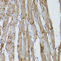 Platelet Derived Growth Factor Receptor Alpha (PDGFRA) Antibody