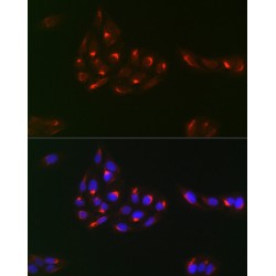 Platelet Derived Growth Factor Receptor Alpha (PDGFRA) Antibody