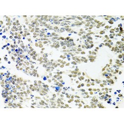 Protein Phosphatase 4 Catalytic Subunit (PPP4C) Antibody