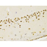 Immunohistochemistry analysis of paraffin-embedded Rat brain using PTEN Antibody at dilution of 1/200 (40x lens). Microwave antigen retrieval performed in 0.01 M PBS Buffer (pH 7.2) prior to IHC staining.