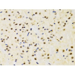 Phosphatidylinositol-3,4,5-Trisphosphate 3-Phosphatase And Dual-Specificity Protein Phosphatase PTEN (PTEN) Antibody