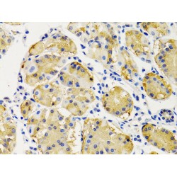 Phosphatidylinositol-3,4,5-Trisphosphate 3-Phosphatase And Dual-Specificity Protein Phosphatase PTEN (PTEN) Antibody