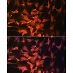 Phosphatidylinositol-3,4,5-Trisphosphate 3-Phosphatase And Dual-Specificity Protein Phosphatase PTEN (PTEN) Antibody