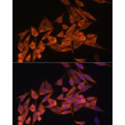 Phosphatidylinositol-3,4,5-Trisphosphate 3-Phosphatase And Dual-Specificity Protein Phosphatase PTEN (PTEN) Antibody