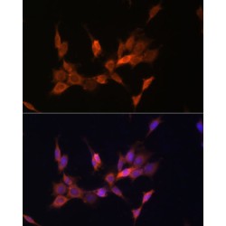Phosphatidylinositol-3,4,5-Trisphosphate 3-Phosphatase And Dual-Specificity Protein Phosphatase PTEN (PTEN) Antibody