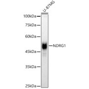 Western blot analysis of lysates from U-87MG cells, using [KO Validated] NDRG1 Antibody at 1/1000 dilution. Secondary antibody: HRP-conjugated Goat anti-Rabbit IgG (H+L) at 1/10000 dilution. Lysates/proteins: 25 µg per lane. Blocking buffer: 3% nonfat dry milk in TBST. Exposure time: 30s.