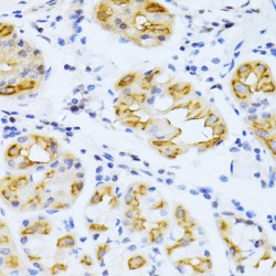 Cytochrome P450 2E1 (CYP2E1) Antibody
