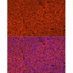 Cytochrome P450 2E1 (CYP2E1) Antibody
