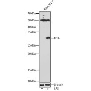 Western blot analysis of various lysates using at 1/1000 dilution. Raw264. 7 cells were treated by LPS (1 µg/ml) at 37 °C for 8 hours. Secondary antibody: HRP-conjugated Goat anti-Rabbit IgG (H+L) at 1/10000 dilution. Lysates/proteins: 25 µg per lane. Blocking buffer: 3% nonfat dry milk in TBST. Exposure time: 180s.