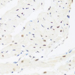 Interferon Regulatory Factor 3 (IRF3) Antibody