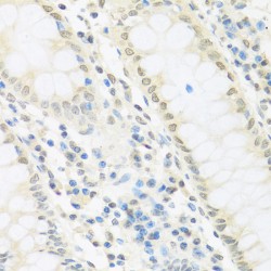 Interferon Regulatory Factor 3 (IRF3) Antibody