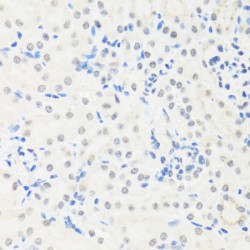 Interferon Regulatory Factor 3 (IRF3) Antibody