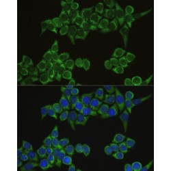 Interferon Regulatory Factor 3 (IRF3) Antibody