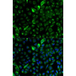 Keratin 17 (KRT17) Antibody