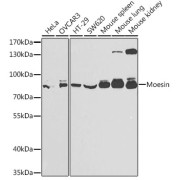 Western blot analysis of various lysates using Moesin Antibody at 1/1000 dilution. Secondary antibody: HRP-conjugated Goat anti-Rabbit IgG (H+L) at 1/10000 dilution. Lysates/proteins: 25 µg per lane. Blocking buffer: 3% nonfat dry milk in TBST.