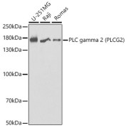 Western blot analysis of various lysates using PLC gamma 2 (PLCG2) Antibody at 1/1000 dilution. Secondary antibody: HRP-conjugated Goat anti-Rabbit IgG (H+L) at 1/10000 dilution. Lysates/proteins: 25 µg per lane. Blocking buffer: 3% nonfat dry milk in TBST.