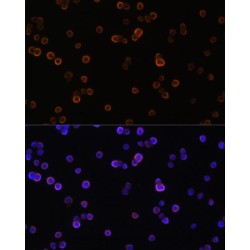 Phospholipase C Gamma 2, Phosphatidylinositol Specific (PLCG2) Antibody