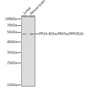 Western blot analysis of various lysates using PP2A-B55α/PR55α/PPP2R2A Antibody at 1/1000 dilution. Secondary antibody: HRP-conjugated Goat anti-Rabbit IgG (H+L) at 1/10000 dilution. Lysates/proteins: 25 µg per lane. Blocking buffer: 3% nonfat dry milk in TBST.