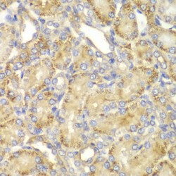 Protein Phosphatase 2 Regulatory Subunit Balpha (PPP2R2A) Antibody