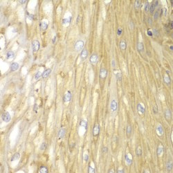 Protein Phosphatase 2 Regulatory Subunit Balpha (PPP2R2A) Antibody