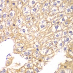 Protein Phosphatase 2 Regulatory Subunit Balpha (PPP2R2A) Antibody