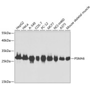 Western blot analysis of various lysates using PSMA6 Antibody at 1/1000 dilution. Secondary antibody: HRP-conjugated Goat anti-Rabbit IgG (H+L) at 1/10000 dilution. Lysates/proteins: 25 µg per lane. Blocking buffer: 3% nonfat dry milk in TBST.