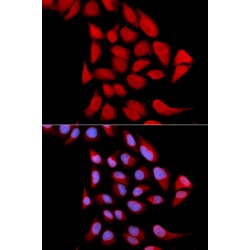 Proteasome Subunit Alpha Type 6 (PSMA6) Antibody