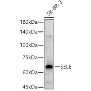 Western blot analysis of lysates from SK-BR-3 cells, using SELE Antibody at 1/1000 dilution. Secondary antibody: HRP-conjugated Goat anti-Rabbit IgG (H+L) at 1/10000 dilution. Lysates/proteins: 25 µg per lane. Blocking buffer: 3% nonfat dry milk in TBST. Exposure time: 60s.