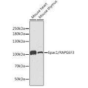 Western blot analysis of various lysates using Epac1/RAPGEF3 Antibody at 1/1000 dilution. Secondary antibody: HRP-conjugated Goat anti-Rabbit IgG (H+L) at 1/10000 dilution. Lysates/proteins: 25 µg per lane. Blocking buffer: 3% nonfat dry milk in TBST.